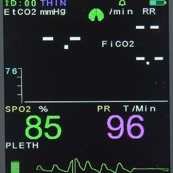 Монитор PC-900B (ветеренария) SpO2 + PR + CO2 арт. AR21173