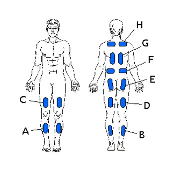 Система функциональной электростимуляции (ФЭС) MHC-16