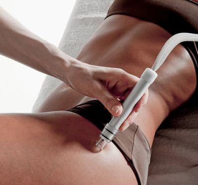 Аппарат микродермабразии Deep Clean арт. Rml21549