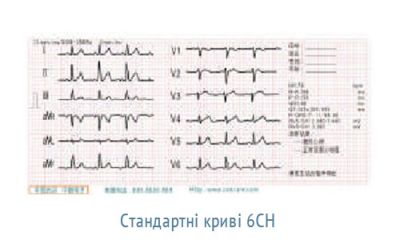 ОБЕРЕГ-1206 - шестиканальный цифровой электрокардиограф арт. 10664