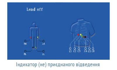 ОБЕРЕГ-1206 - шестиканальный цифровой электрокардиограф арт. 10664