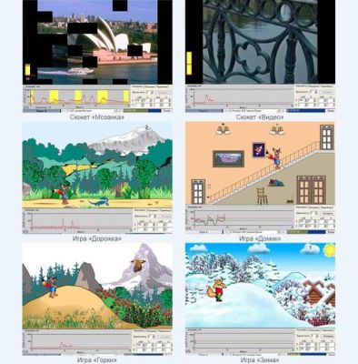 Комплекс БОС опорно-двигательный арт. BSv26926