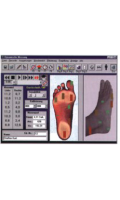 Модуль Ortho-Tronic Cam (цифровая камера) Артикул: 01401003