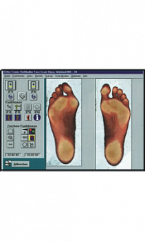 Системный модуль Ortho-Tronic Scan Артикул: 01401000