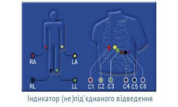 ОБЕРЕГ-1212 - двенадцатиканальный цифровой электрокардиограф арт. 10665